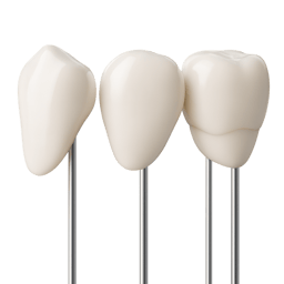Three porcelain veneer crowns on posts
